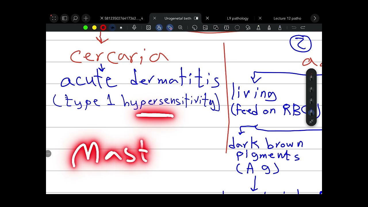L11 PATHOLOGY _belhariziasis