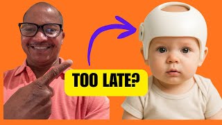 Baby Flat Head Helmet: When It’s Needed (and When It’s Not)