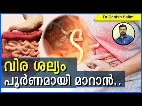 605: 🐛 വിര ശല്യം പൂർണമായി മാറാൻ? Getting rid of Worm Infestations.