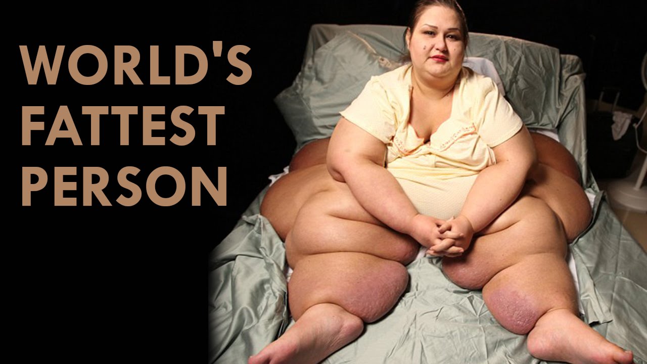 Here is the list of the fattest person in the world.