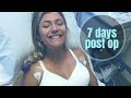 Plastic Surgery Experience / 7 day vlog