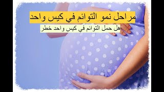 مراحل نمو التوائم في كيس واحد - هل حمل التوائم في كيس واحد خطر ؟