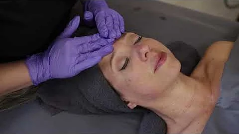 Anti Aging No-Needles Facial Peel, Immediate Results, PRX-T33 Biorevitalization | Medical Spa NJ