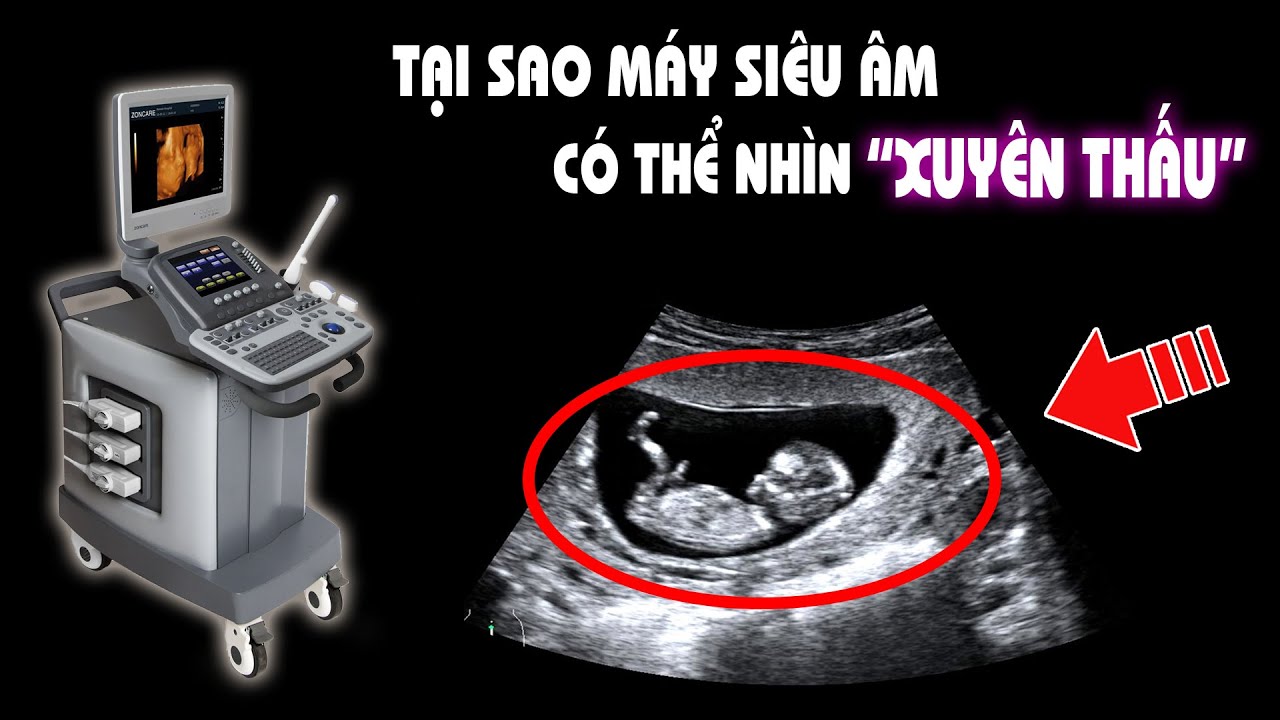 Máy siêu âm chụp ảnh 