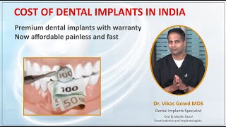 How Much Does a Dental Implant Cost in Hyderabad? | Best Dental Clinic in Hyderabad screenshot 3