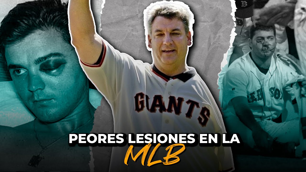 Las peores lesiones de la MLB 🥵 (Terribles lesiones que acabaron ...