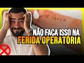 Cuidados com a ferida operatria  feridas e curativos