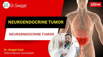 Neuroendocrine Cancer I Neuroendocrine Tumour  in Hindi I Dr. Swagat Dash