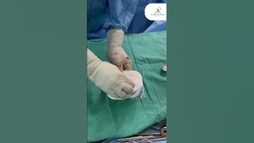 Unboxing Opulent Kit - What Surgeons Use | Dr Nikil S Paramesh