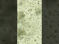 Urine Test Report-এ Pus Cell দেখলে কী বুঝবেন? 😨 #shorts