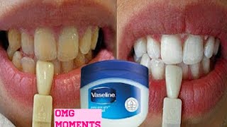 Turn dirty yellow teeth to White in just 3 minutes screenshot 2