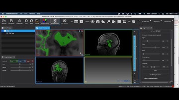 MPHY0026 Lecture7, Segmentation: RegionGrowing
