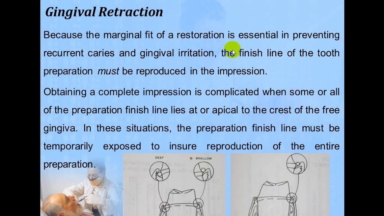 Periodontal-fixed prosthodontics interrelationship