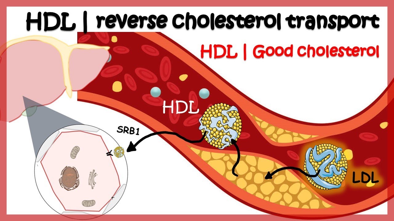 Cholesterol Cholesterol: Top