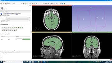 Como realizar uma segmentação cerebral utilizando o Slicer 3D