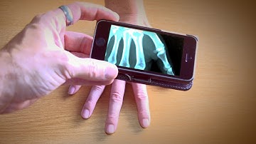 X-ray Effect - Made using Adobe After Effects