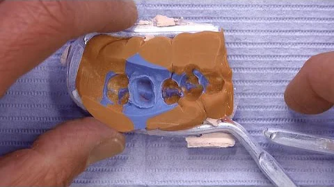 Case of the week: An Example of Good, Bad, and Une...