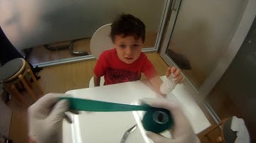 Waterproof Casts