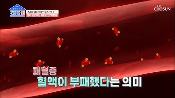 ⧙ㅎㄷㄷ⧘ 급사 일으키는 ‘패혈증’ 이란?  | [건강한 집］ 16회 | TV CHOSUN 20201123 방송