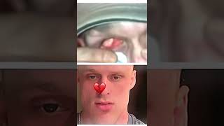 Man Eats His Own Eyeballs Bombastic