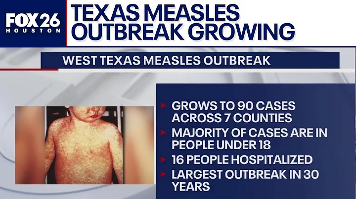 Texas measles outbreak: 90 cases reported since late January, officials say