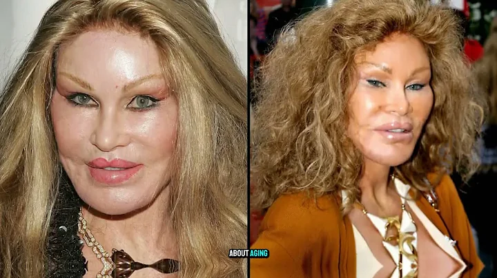 Jocelyn Wildenstein's Transformation Is A Must-See