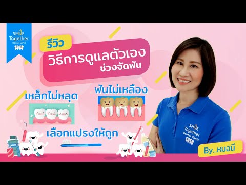 รีวิวทำยังไงไม่ให้เหล็กหลุด+ฟันไม่เหลือง+วิธีการดูแลตัวเองช่วงจัดฟัน