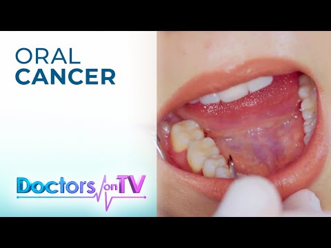 Video: Paggamot sa Black Canker Disease: Ano ang Gagawin Para sa Black Canker sa Mga Puno