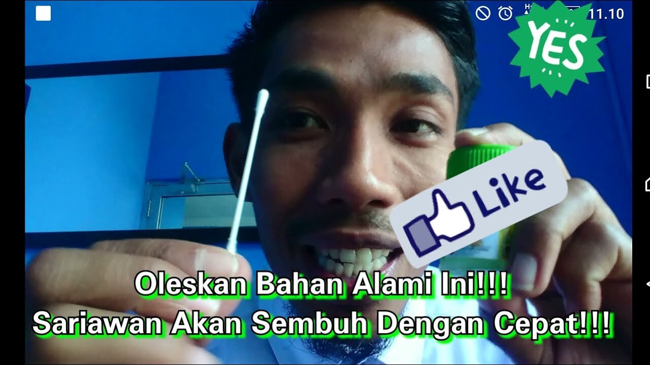 TIPS MENYEMBUHKAN SARIAWAN DENGAN MUDAH!!! 