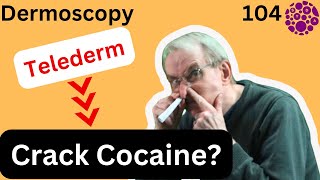 Is Telederm  the crack cocaine of Primary Care Dermatology? [spoiler alert: it is]