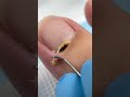 Satisfying nail cleaning process#nailcare #pedicure #satisfying #nailtech #oddlysatisfying #fyp