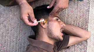 ASMR Fast & Aggressive Ear Oili Massage For Sleep