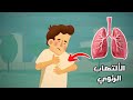ما هو الالتهاب الرئوي وما هي أسبابة وطرق علاجة   