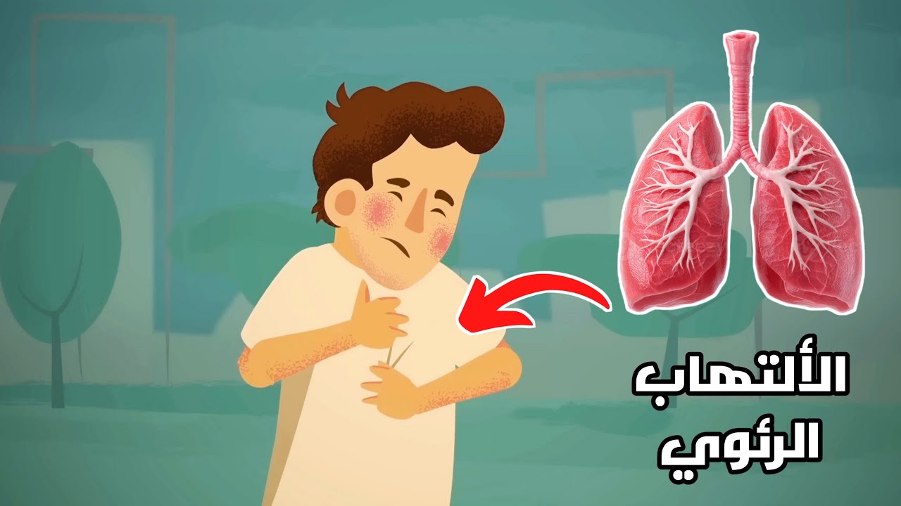 ما هو الالتهاب الرئوي وما هي أسبابة وطرق علاجة؟_ ? What is pneumonia
