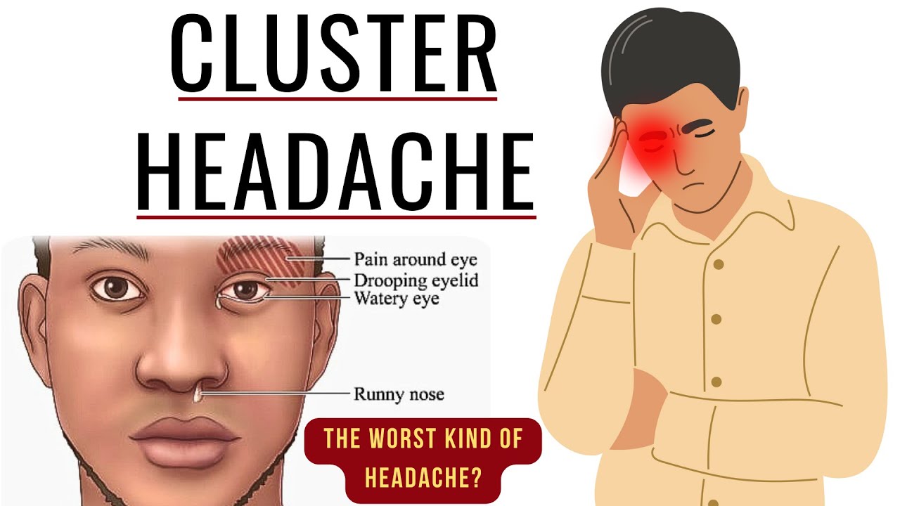 cluster-headaches-explained-the-most-painful-type-of-headache-youtube