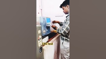 CBC test #lab #technician #cbc #test #comment #subscribe #lt #shorts #viral