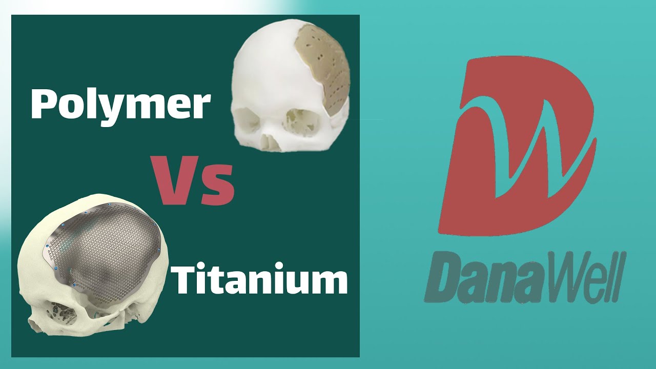 Titanium vs Polymer Patient Specific Skull Implants: What’s the Real Difference? [DanaWell Company]