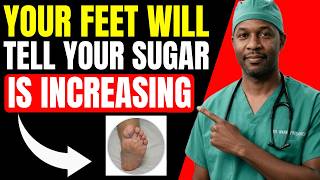 9 Warning Signs in Your Feet That Could Mean Diabetes | Dr. Wayne Fredrick 9 Warning Signs In Your Feet That Could Mean Diabetes