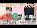 小陰唇縮小 と副皮切除で女性のお悩みを解消!