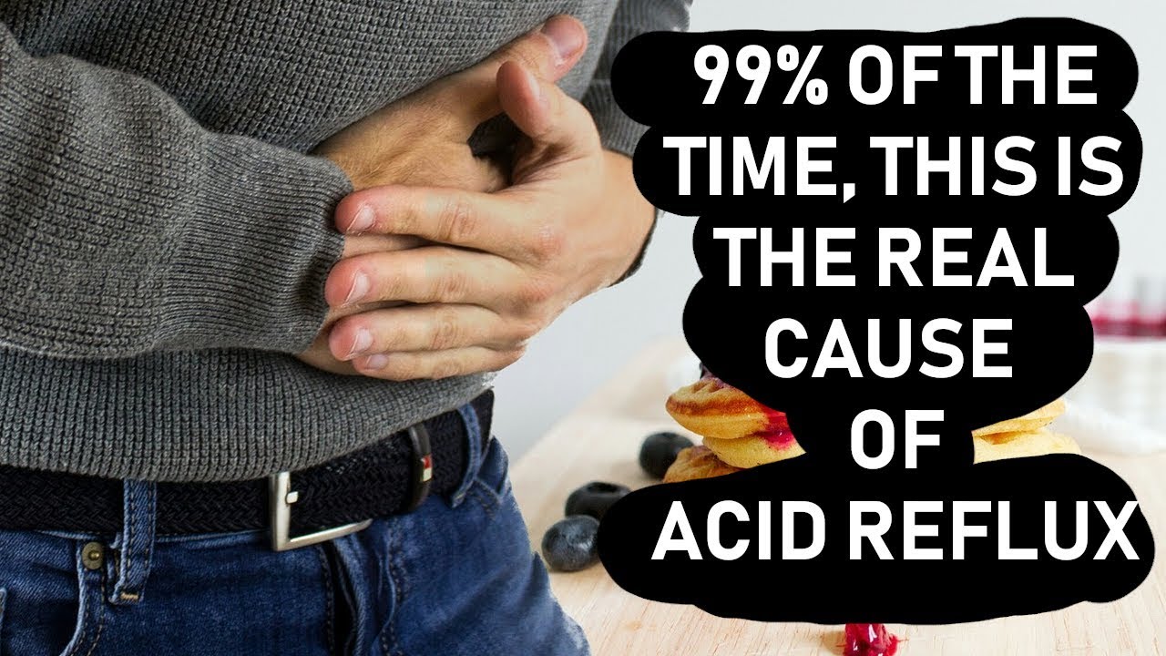 🔥🔥🔥 Heartburn, Acid Reflux and Hair Loss 99 of the Time it is Caused
