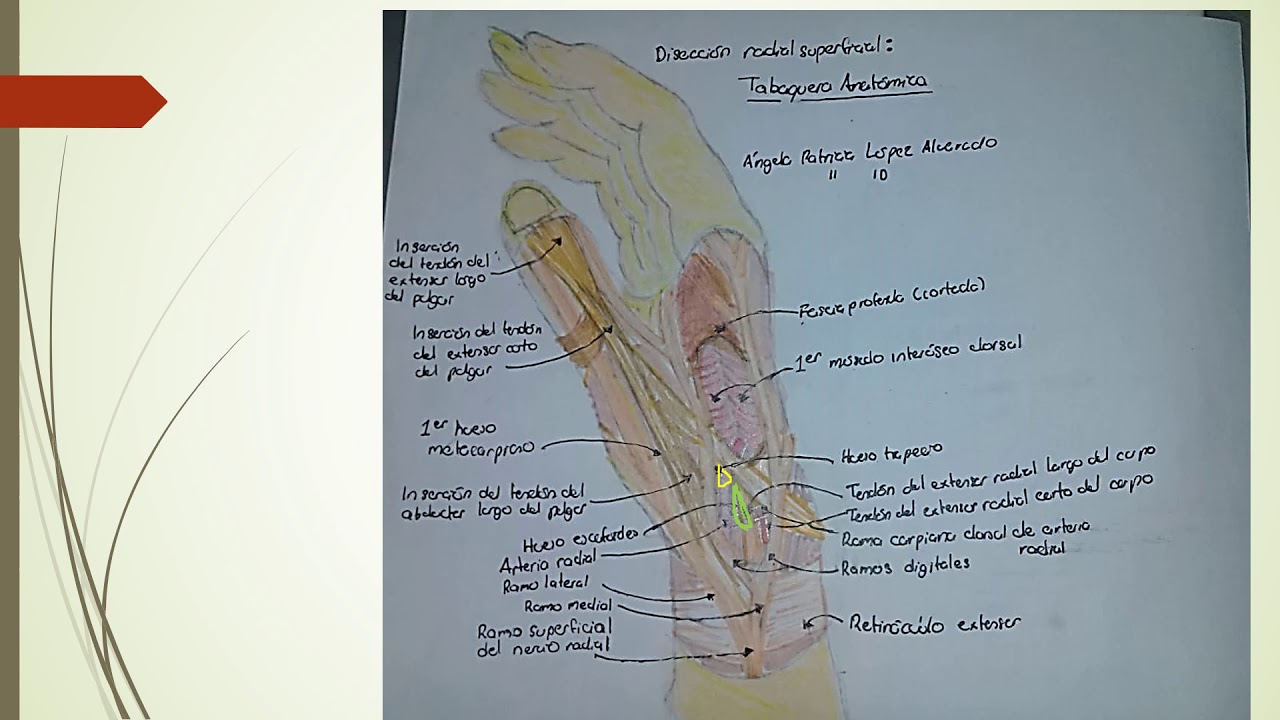 Disección Radial Superficial: Tabaquera Anatómica