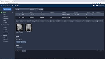 Hip Dysplasia Measurement Tool | Veterinary Image Management Software | Keystone Omni