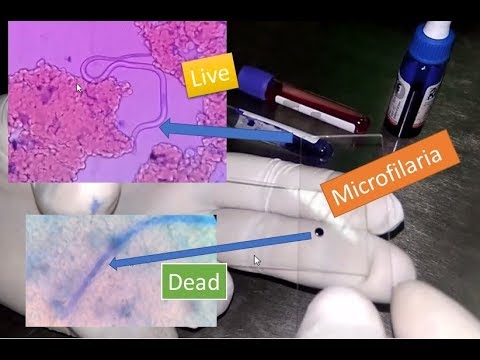 Video: Jak lze mikrofilárii léčit?