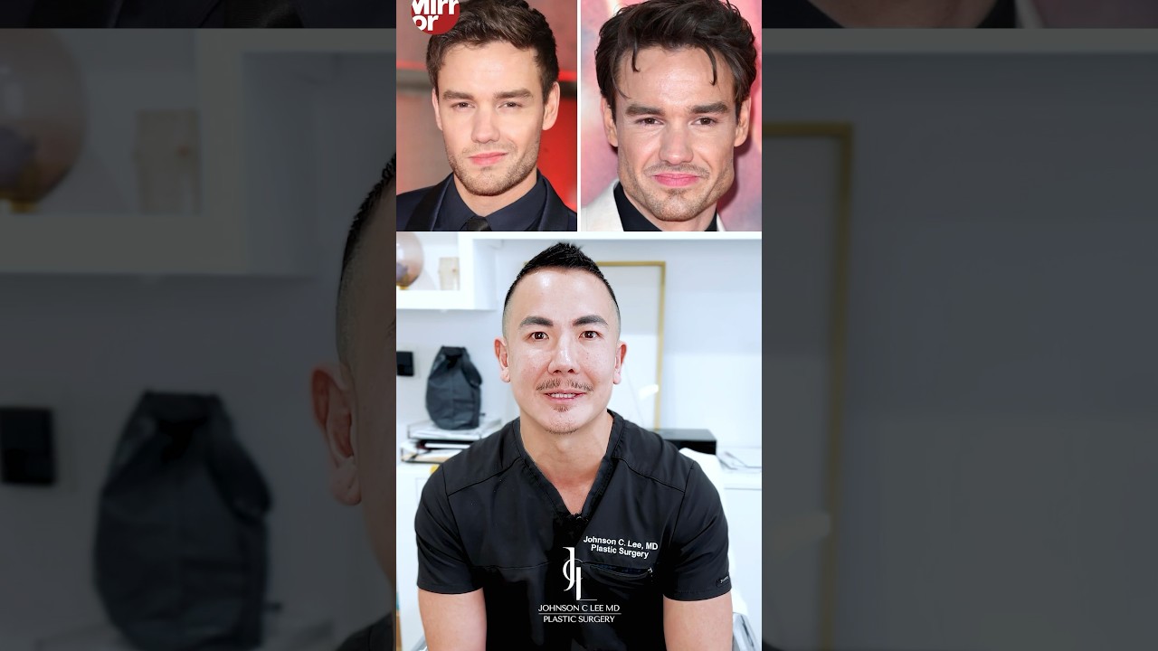 🔥 HOT TOPIC: Is LIAM PAYNE’s Jawline REAL or FAKE? 📐 Dr. Johnson C. Lee | Beverly Hills, CA
