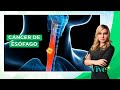 Cáncer de esófago, ¿cómo se forma? | Vive Más