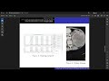 Fuzzy Logic and Neural Networks for Disease Detection and Simulation in MATLAB