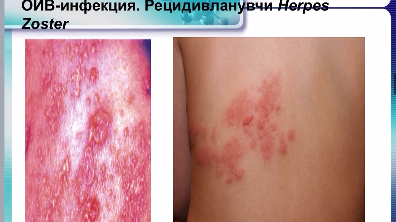 Ол жүктегішті сорып алды Кемпір зейіп жатыр