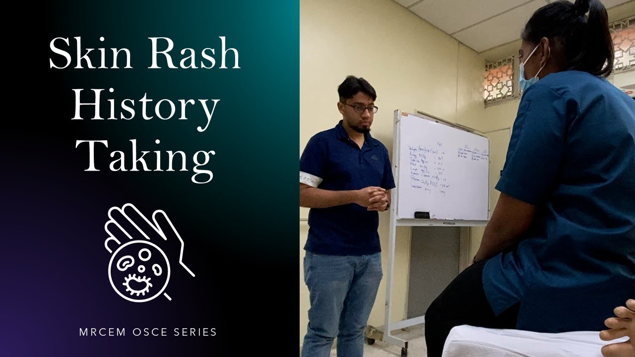 MRCEM OSCE - Skin Rash History Taking - YouTube