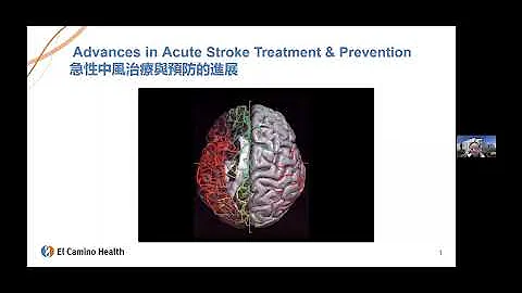 Advances in Acute Stroke Treatment & Prevention“急性中风治疗与预防的进展”神经内科冯振中医师主讲 | El Camino Health - 天天要闻