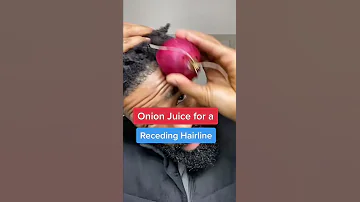 Onion Juice for a Receding Hair Line #shorts